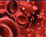 Idiopathic Thrombocytopenia Purpura (ITP)