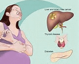 Intrahepatic Cholestasis of Pregnancy (ICP)