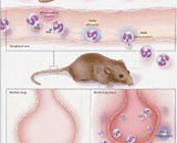 Systemic Inflammatory Response Syndrome (SIRS)