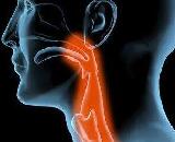Respiratory Failure (RF)