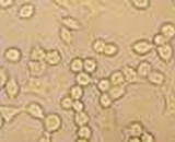 Peripheral Blood Mononuclear Cells (PBMC)