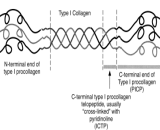 Procollagen I (PCI)