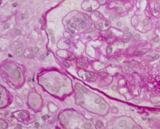 Renal Artery Smooth Muscle Cells (RASMC)