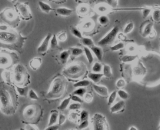 Thymic Epithelial Cells (TEC)