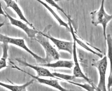 Trabecular Meshwork Cells (TMC)