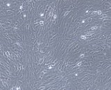 Tracheal Fibroblasts (TrF)