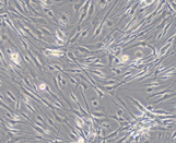Trigeminal Ganglion Astrocytes (TGA)