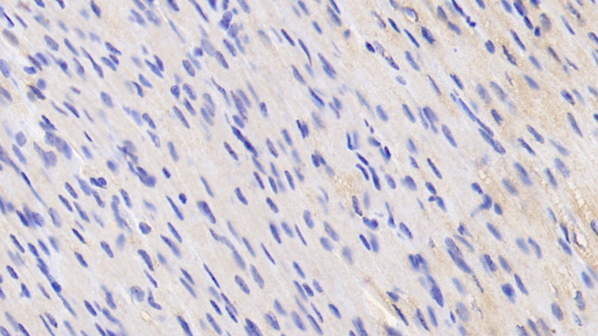 Anti-Vinculin (VCL) Polyclonal Antibody