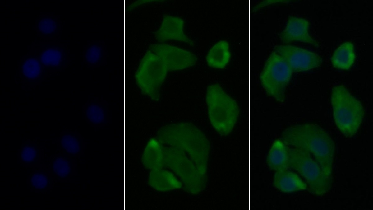 FITC-Linked Monoclonal Antibody to Annexin V (ANXA5)