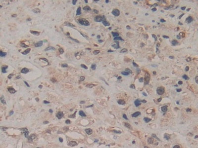 Monoclonal Antibody to Amphiregulin (AREG)