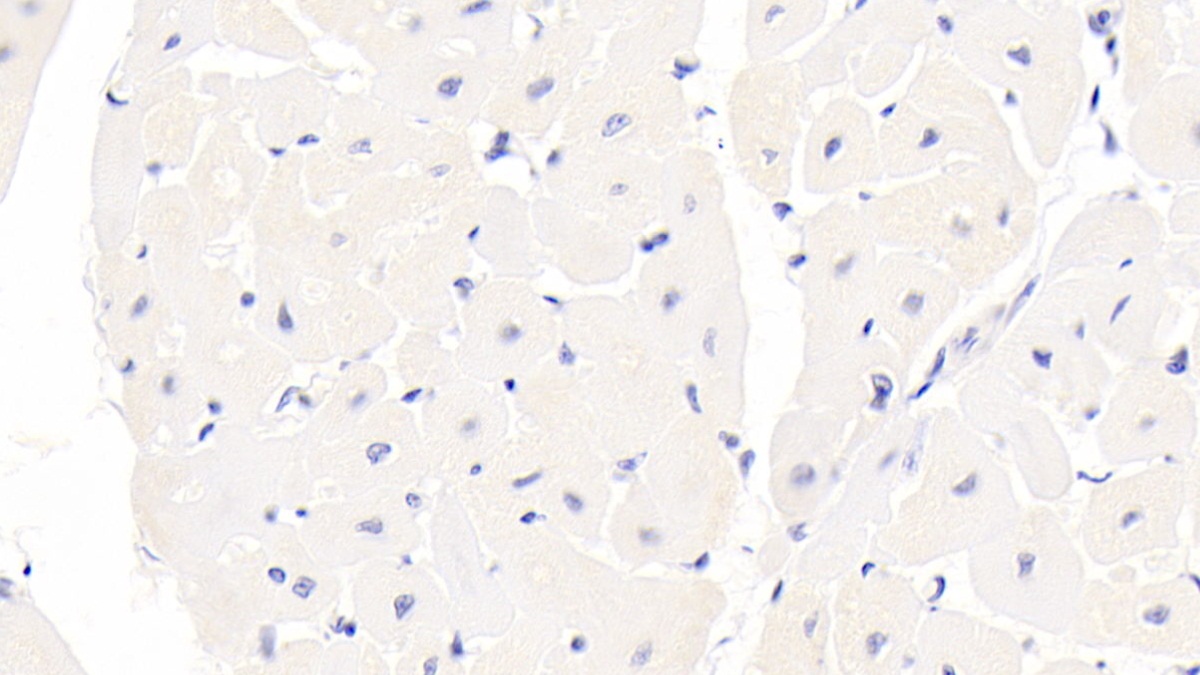 Monoclonal Antibody to S100 Calcium Binding Protein (S100)