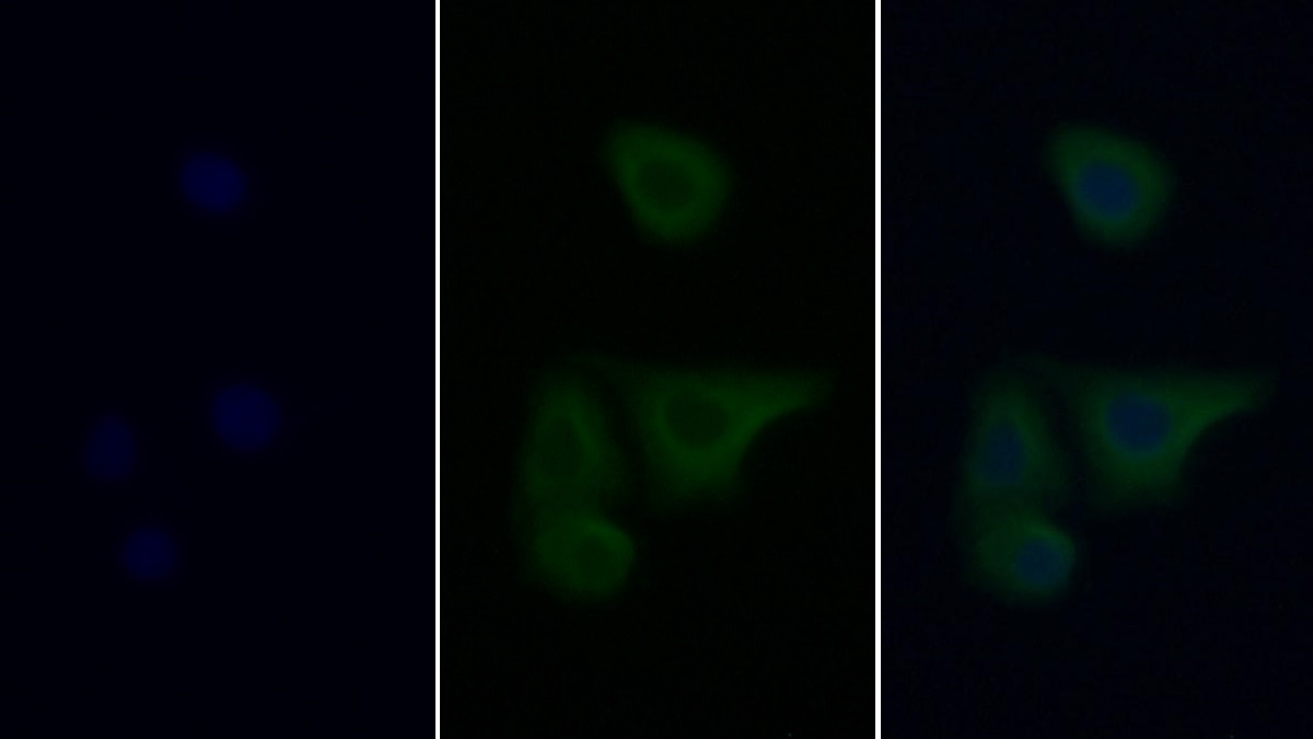 Monoclonal Antibody to Insulin Like Growth Factor 1 (IGF1)