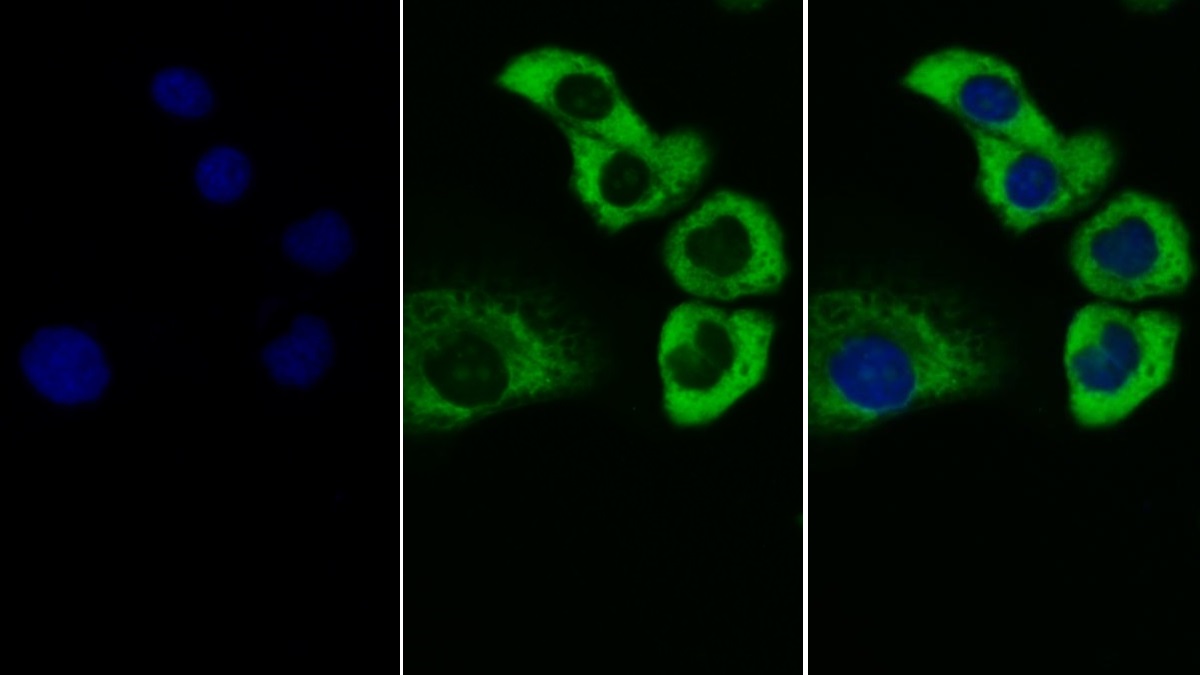 Monoclonal Antibody to Insulin Like Growth Factor 1 (IGF1)