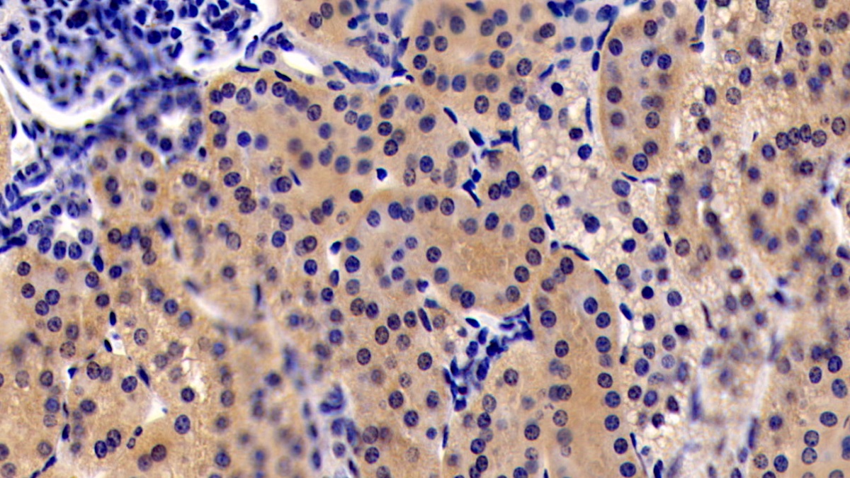 Monoclonal Antibody to Insulin Like Growth Factor 1 (IGF1)