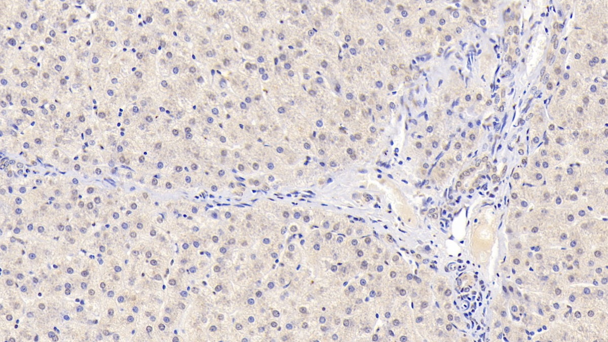 Monoclonal Antibody to Insulin Like Growth Factor Binding Protein 1 (IGFBP1)