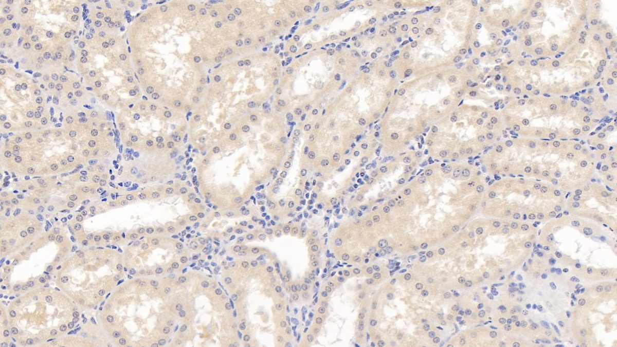 Monoclonal Antibody to Interleukin 10 (IL10)