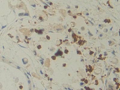 Monoclonal Antibody to Interleukin 12A (IL12A)