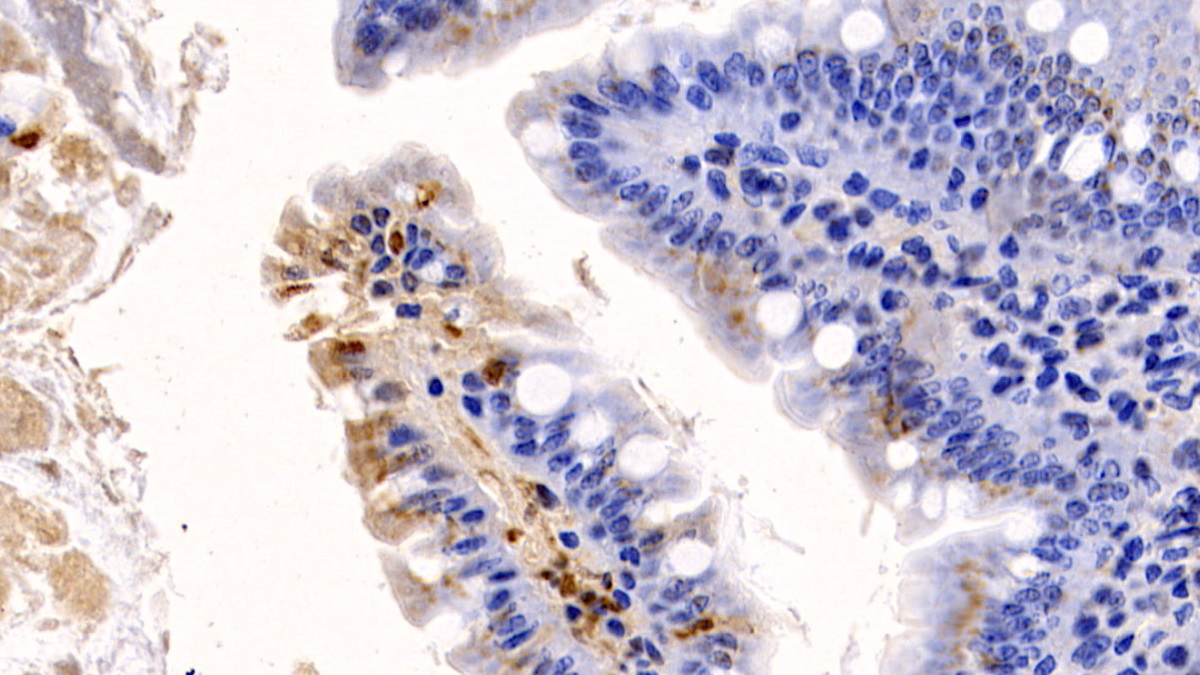 Monoclonal Antibody to Interleukin 17 (IL17)