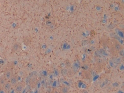 Monoclonal Antibody to Glial Fibrillary Acidic Protein (GFAP)