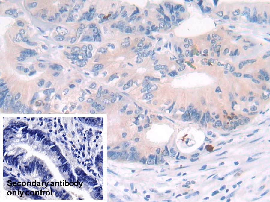 Monoclonal Antibody to Interleukin 4 (IL4)