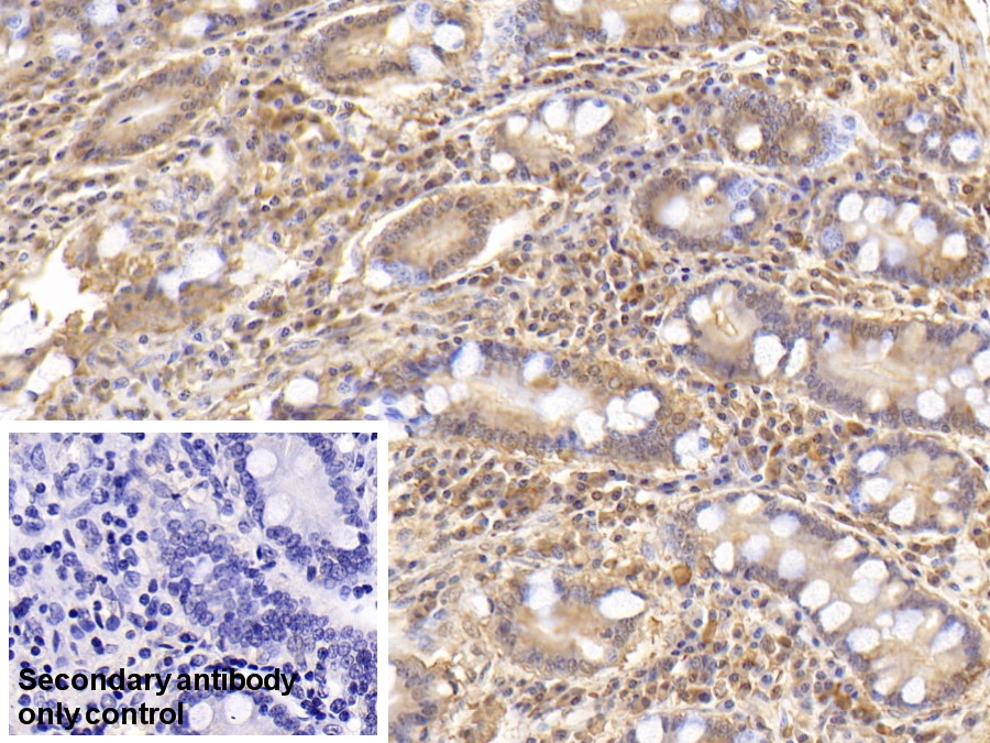 Monoclonal Antibody to Interleukin 6 (IL6)