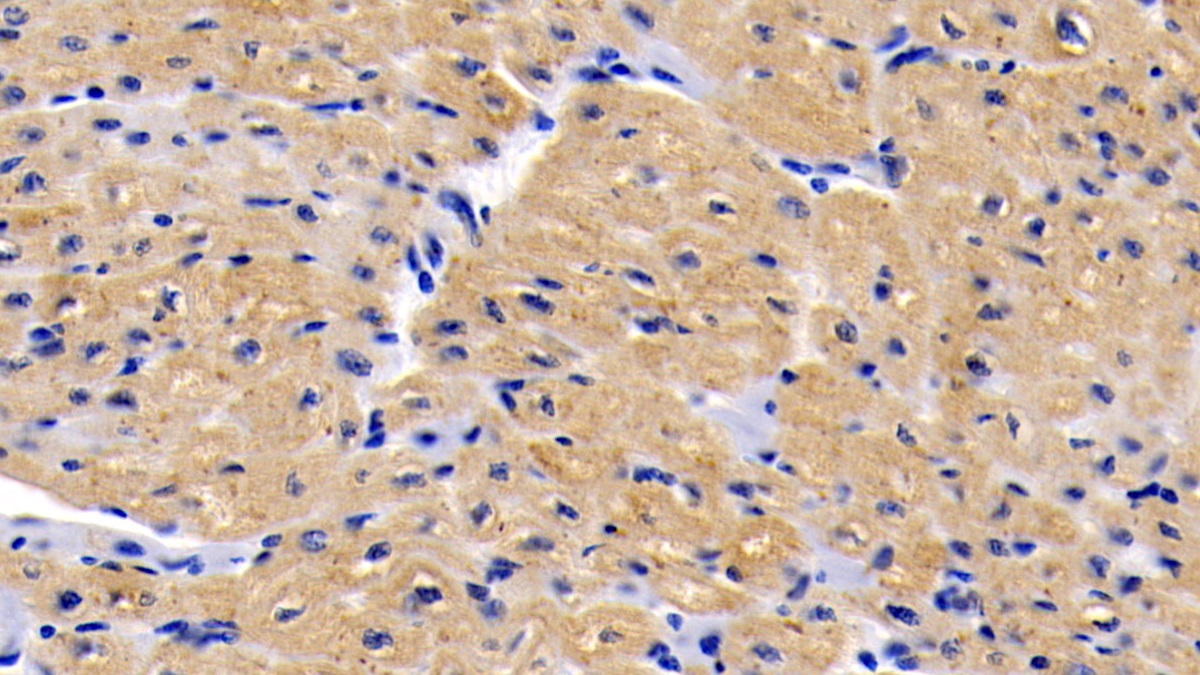 Monoclonal Antibody to Interleukin 6 (IL6)