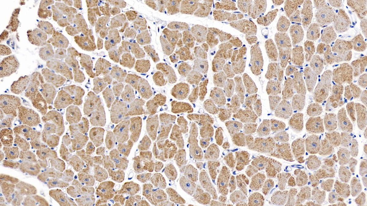 Monoclonal Antibody to Interleukin 6 (IL6)