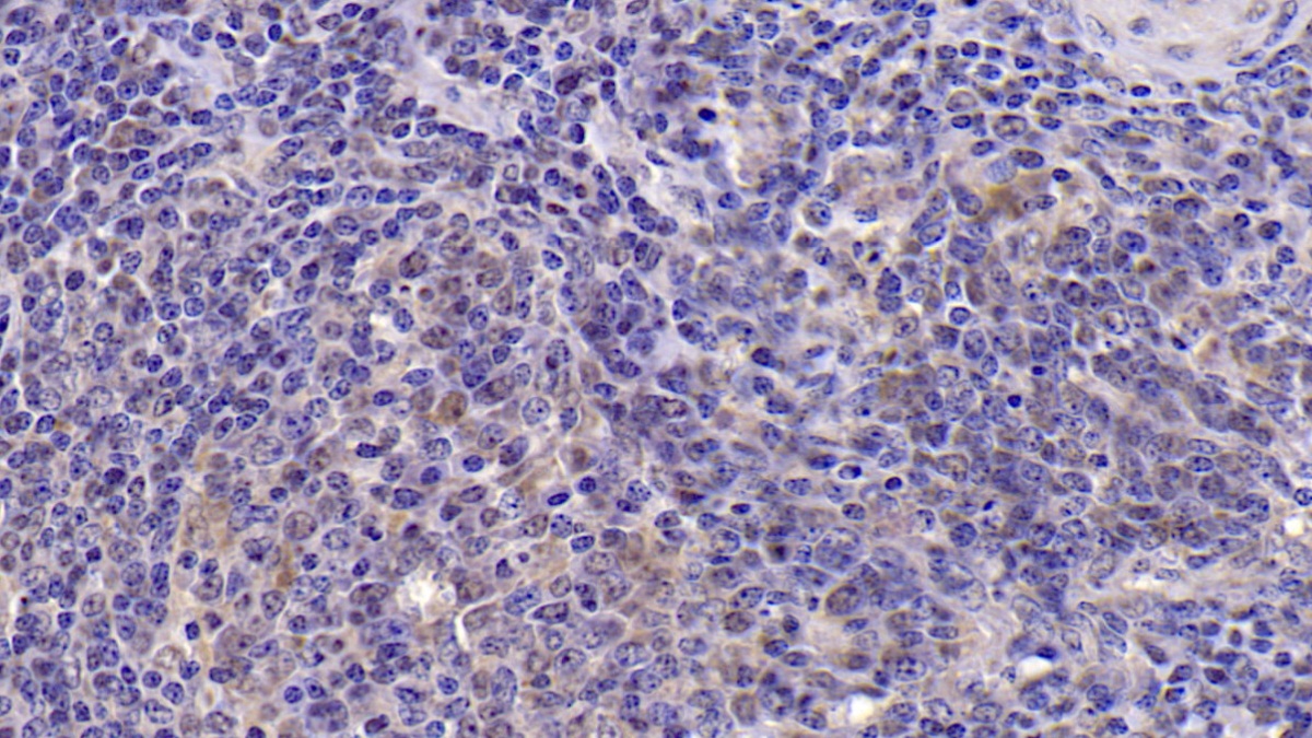Monoclonal Antibody to Interleukin 6 (IL6)