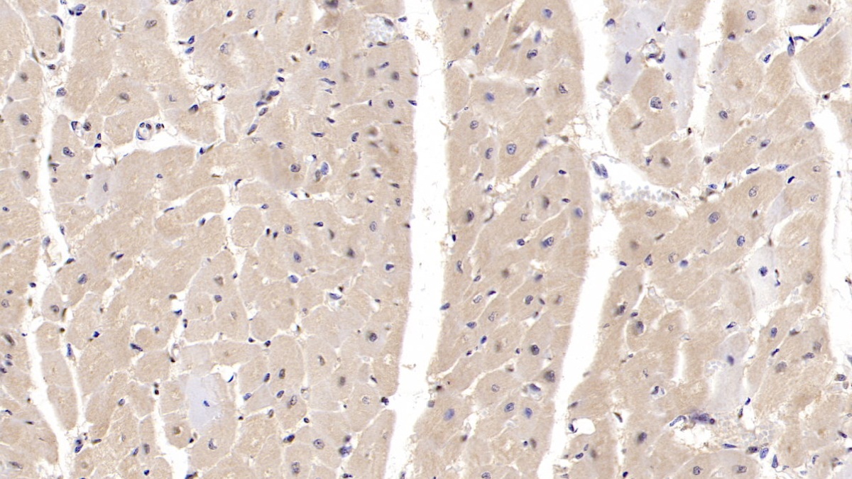 Monoclonal Antibody to Interleukin 6 (IL6)