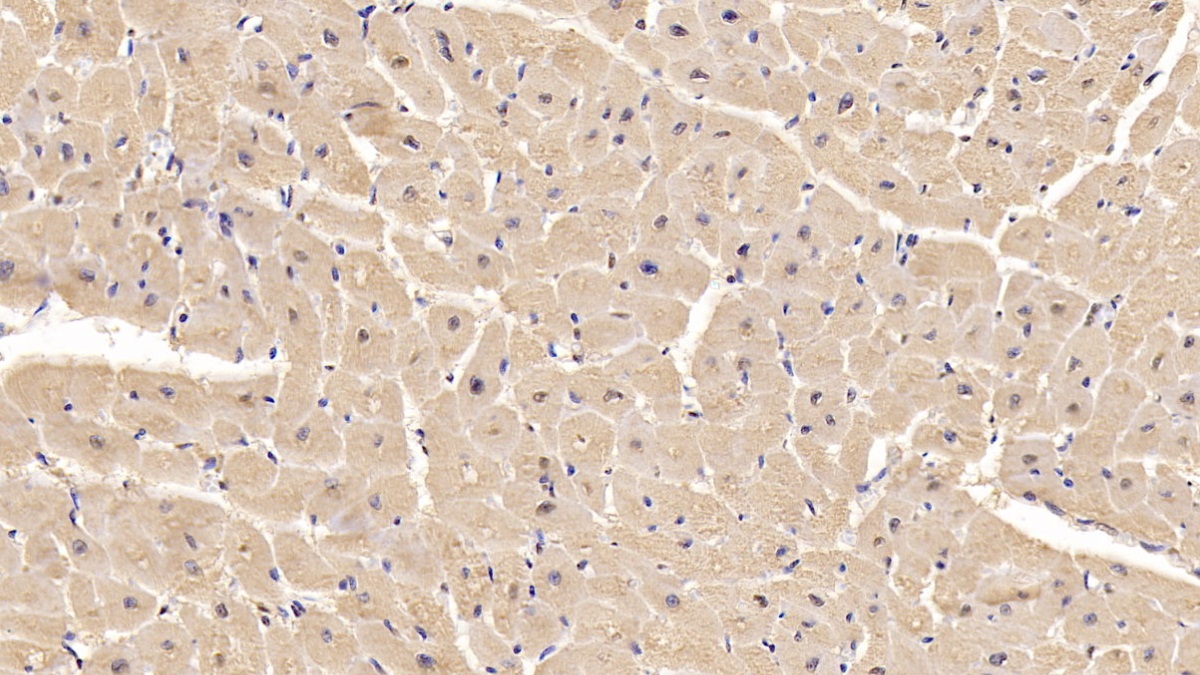 Monoclonal Antibody to Interleukin 6 (IL6)