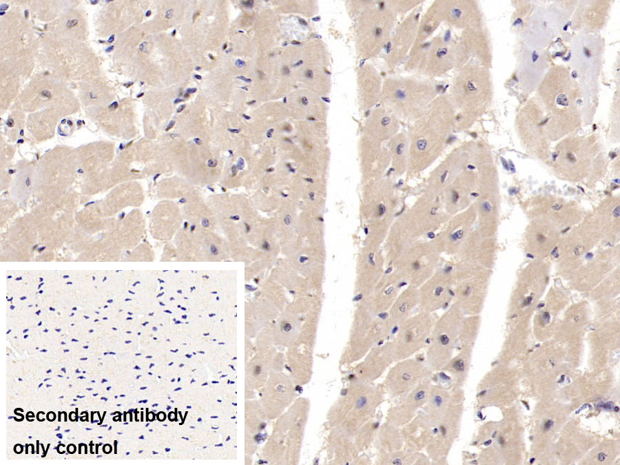 Monoclonal Antibody to Interleukin 6 (IL6)