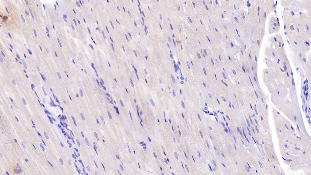 Monoclonal Antibody to Interleukin 6 (IL6)