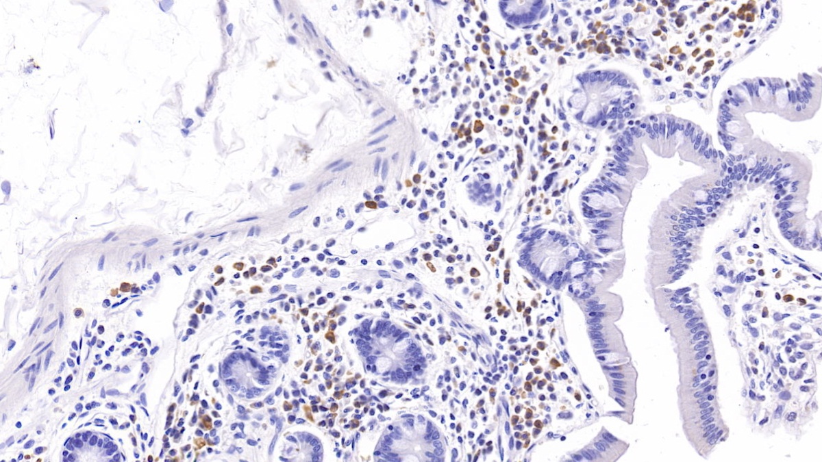 Monoclonal Antibody to Interleukin 6 (IL6)