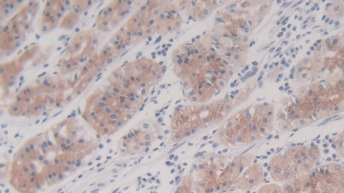 Monoclonal Antibody to Interleukin 8 (IL8)