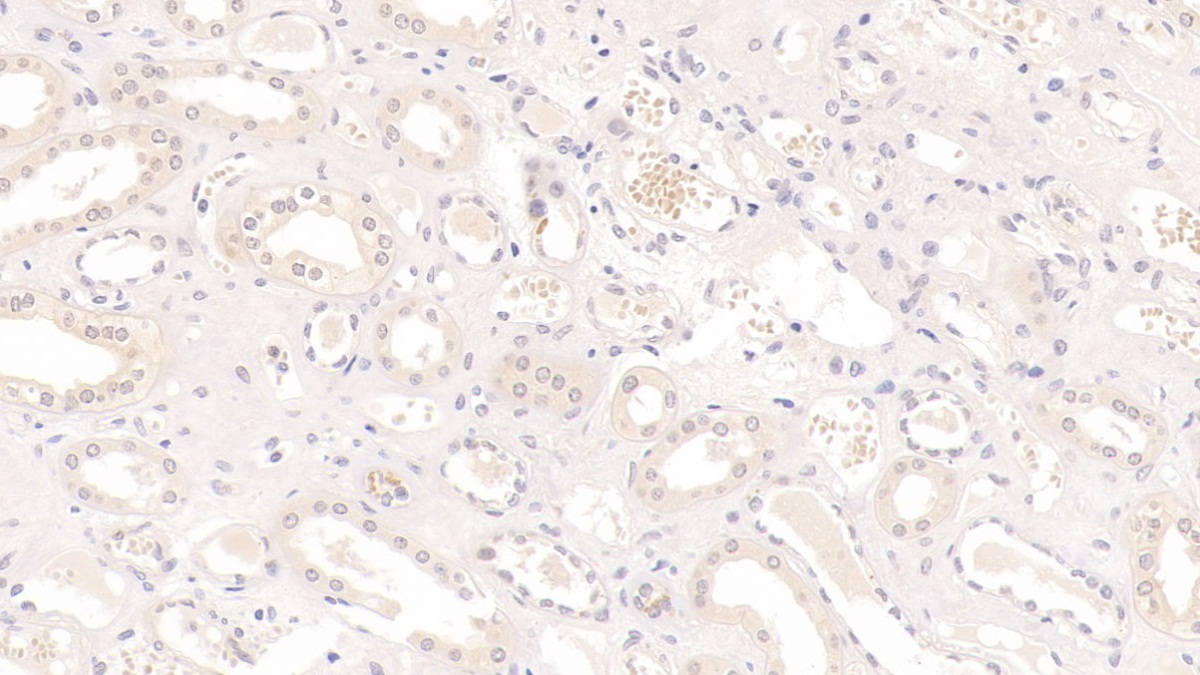 Monoclonal Antibody to Interleukin 9 (IL9)