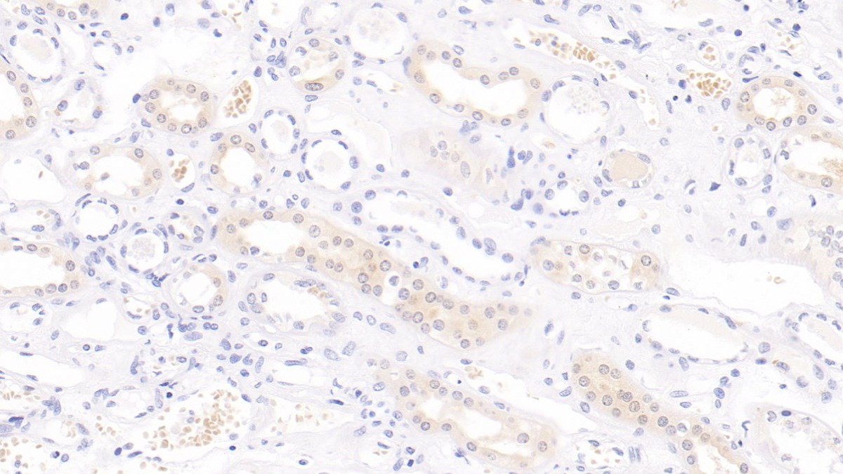 Monoclonal Antibody to Interleukin 9 (IL9)