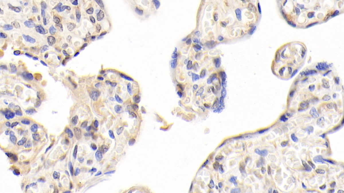 Monoclonal Antibody to Leptin (LEP)