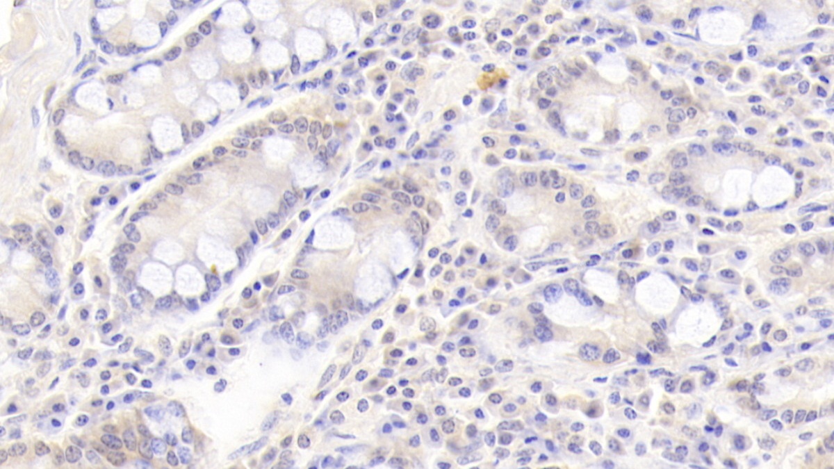 Monoclonal Antibody to Leukemia Inhibitory Factor (LIF)