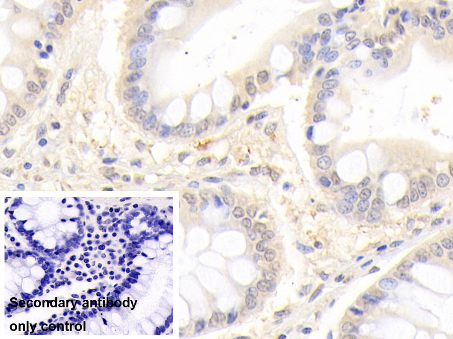 Monoclonal Antibody to Matrix Metalloproteinase 7 (MMP7)