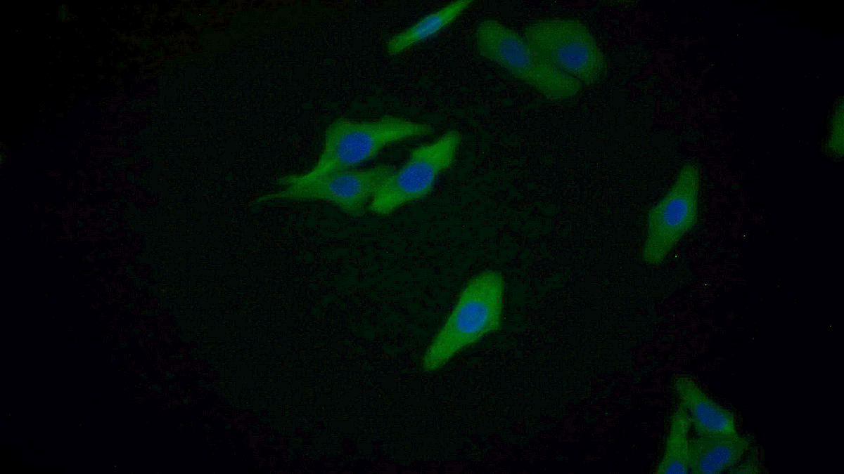 Monoclonal Antibody to Nerve Growth Factor (NGF)