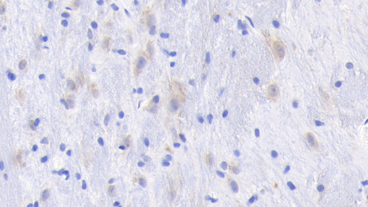 Monoclonal Antibody to Nerve Growth Factor (NGF)