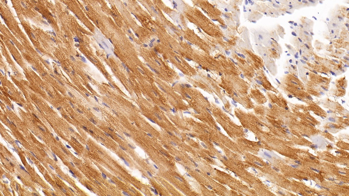 Monoclonal Antibody to Creatine Kinase, Muscle (CKM)