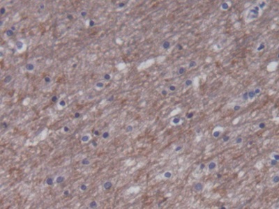 Monoclonal Antibody to Creatine Kinase, Muscle (CKM)