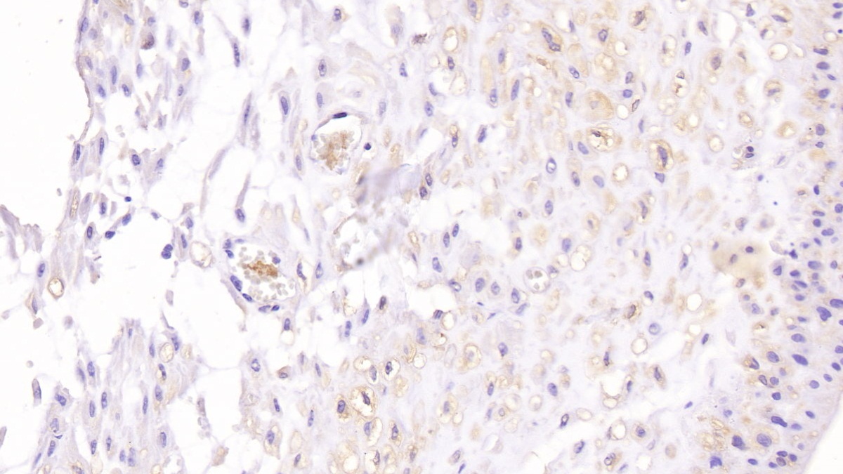 Monoclonal Antibody to Superoxide Dismutase 3, Extracellular (SOD3)