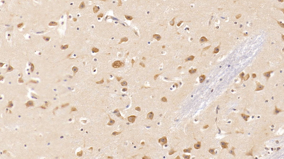 Monoclonal Antibody to Tyrosine Kinase With Immunoglobulin Like And EGF Like Domains Protein 1 (Tie1)