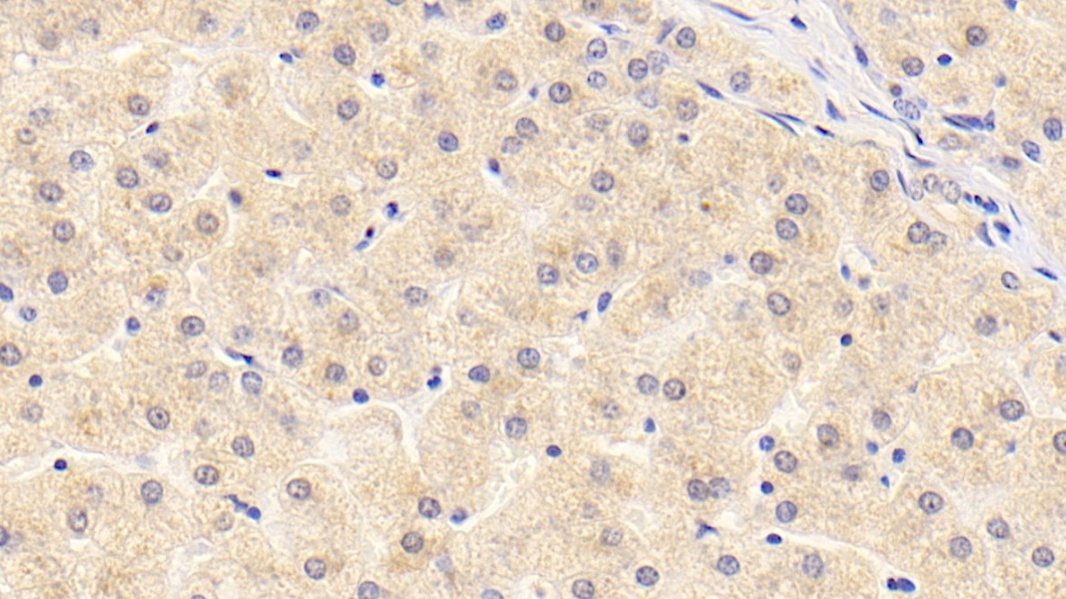 Monoclonal Antibody to Alpha 2-Antiplasmin (a2PI)