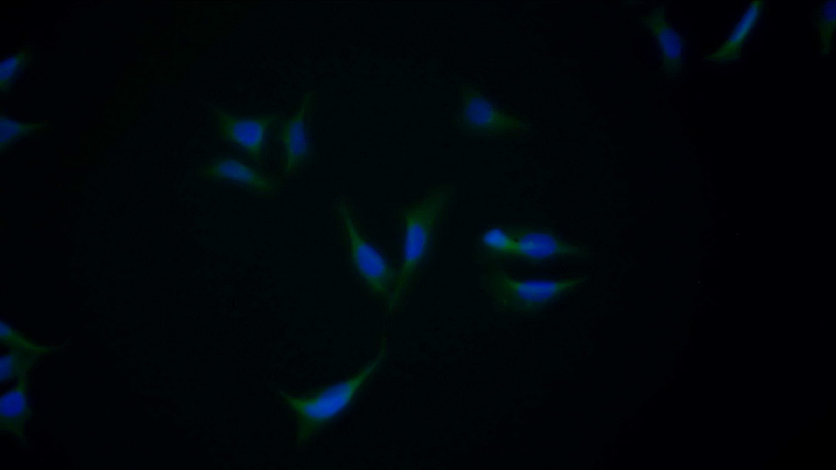 Monoclonal Antibody to Alpha 2-Antiplasmin (a2PI)