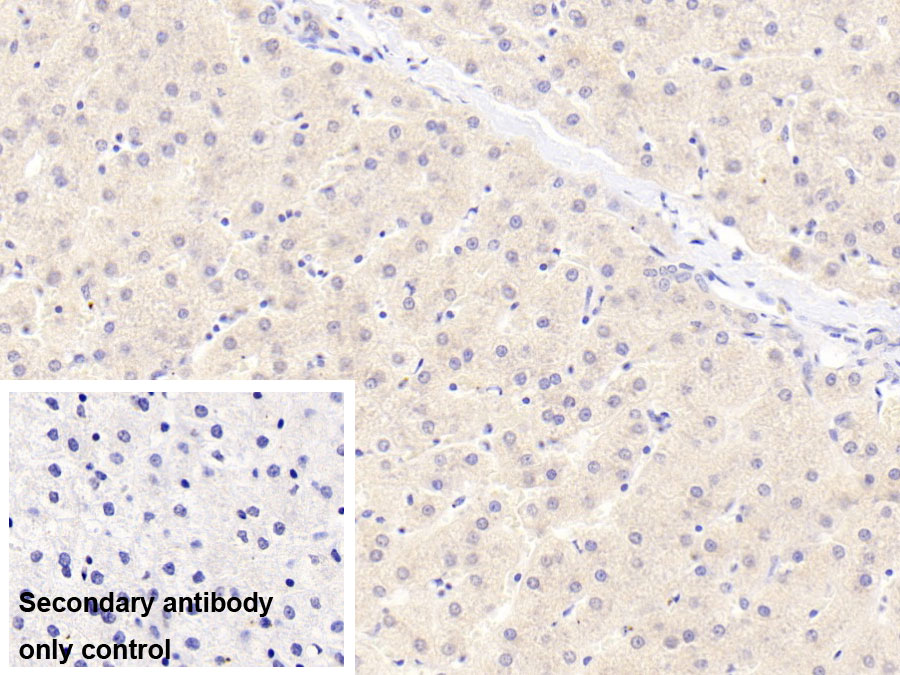 Monoclonal Antibody to Alpha 2-Antiplasmin (a2PI)