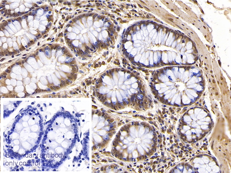 Monoclonal Antibody to Interferon Beta (IFNb)