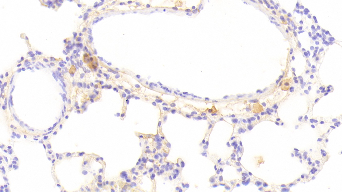 Monoclonal Antibody to Interferon Beta (IFNb)